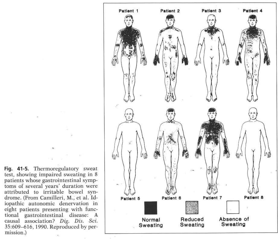 Sweat Spots