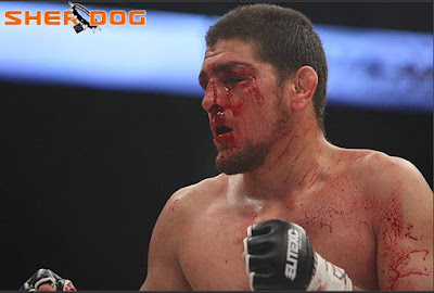 Nick+Diaz%27s+face.JPG