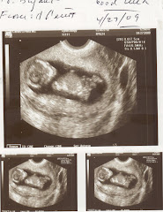 Ultrasound View