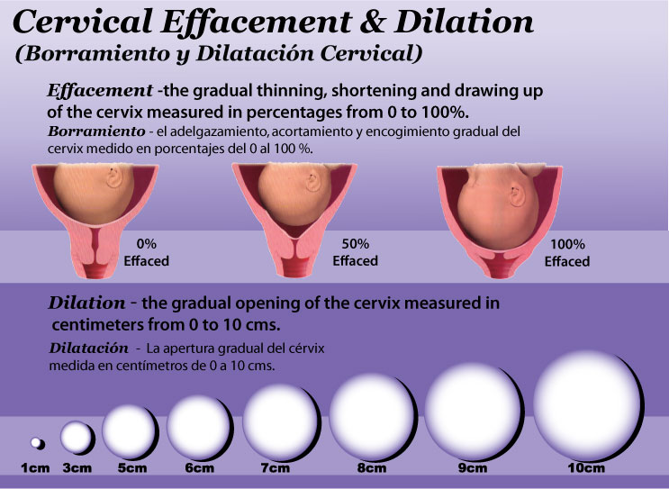 What+does+10+centimeters+dilated+look+like