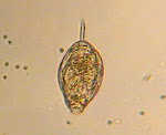 Shelled Rotifer