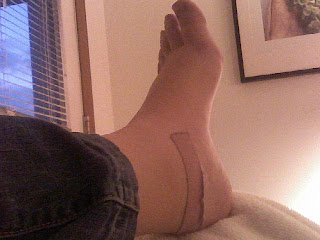 Antisynthetase Syndrome