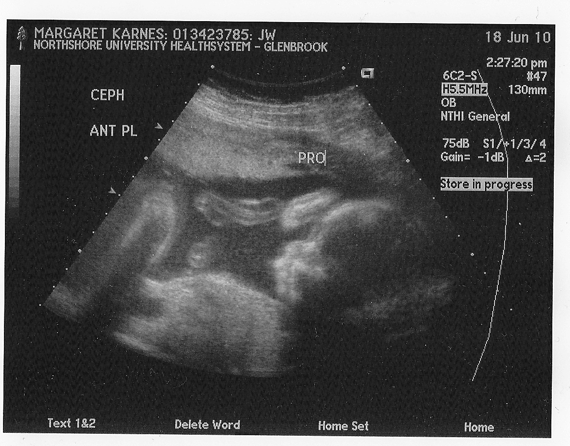 baby boy sonogram baby boy sonogram