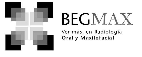 BEGMAX.