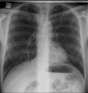 xray report medical trust