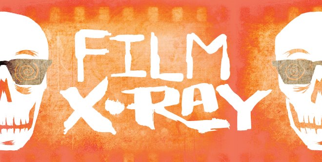 FILM X-RAY
