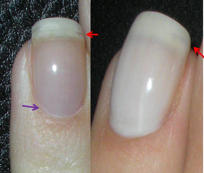 Nail Repair Shellac*^