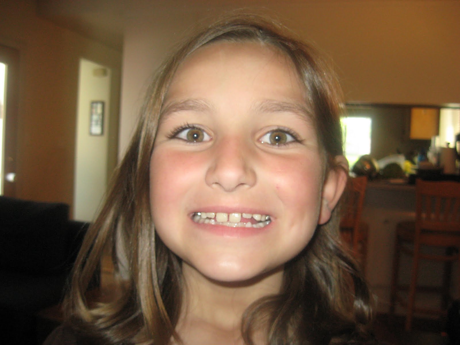 braceface getting braces expander she