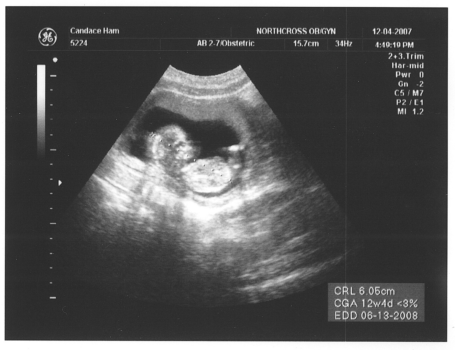 [1st+Baby+Picture+(2).jpeg]