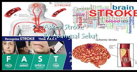 Askep Home Care Pasien Stroke