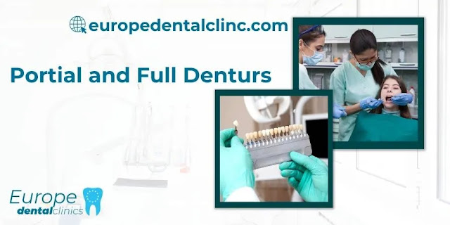 Portial and Full Denturs - Europe Dental Clinic