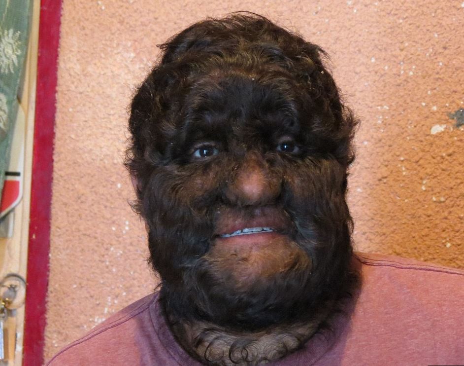Hairiest Woman In The World 56