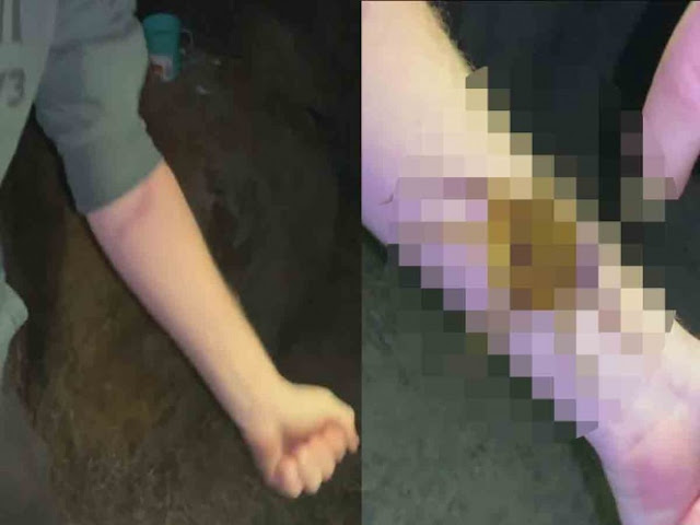 Joven es grabado sosteniendo a un peligroso animal; su veneno puede matar a 26 personas