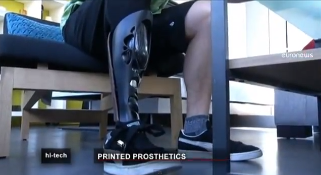 Hi-Tech & Custom Designed 3D Printed Prosthetics | THE ...