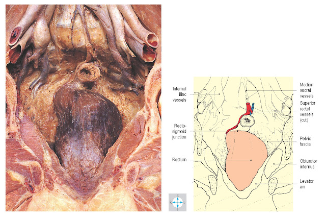 Anterior aspect of rectum seen in a male pelvis sectioned coronally. All peritoneum has been removed.