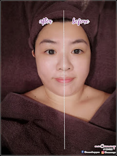 【#療程】講女美分享 || 測試去皺紋神器【8效殲滅皺紋槍】 - Megeve Beauty 皺紋槍好唔好