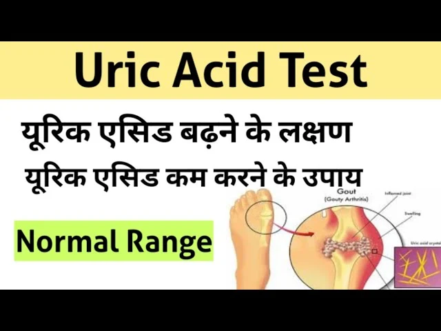 Uric acid symptoms in hindi