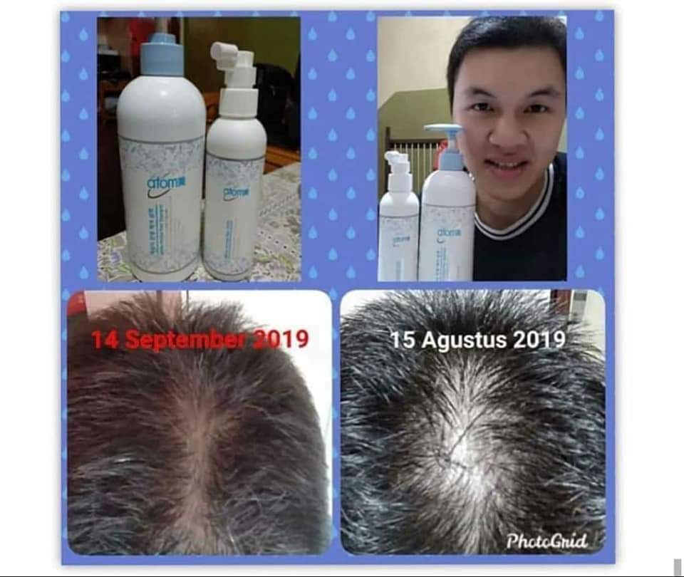 Atomy Herbal shampoo and herbal hair tonic for hair loss solutions