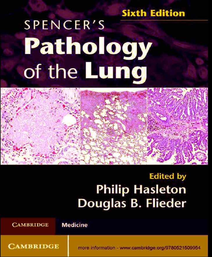 Spencer’s Pathology of the Lung ,6th Edition