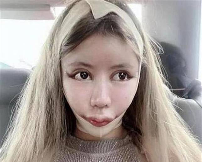 Little Z Nana 100+ Plastic Surgery to Look like a BabyDoll Amazing