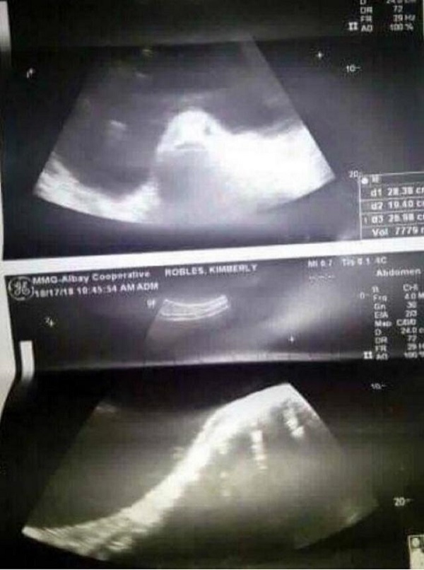 Woman's ultrasound allegedly shows she got pregnant by a fish