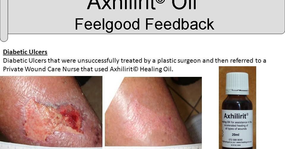 What can I use for Bed Sores, Diabetic Ulcers and Slow Healing Wounds