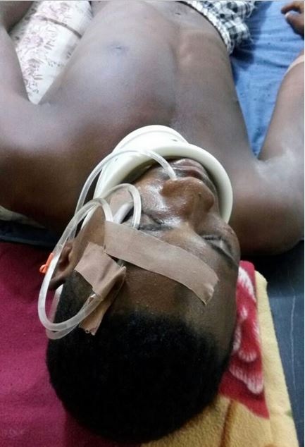 Young Man Beaten to Coma by Police in Adamawa (Photos)