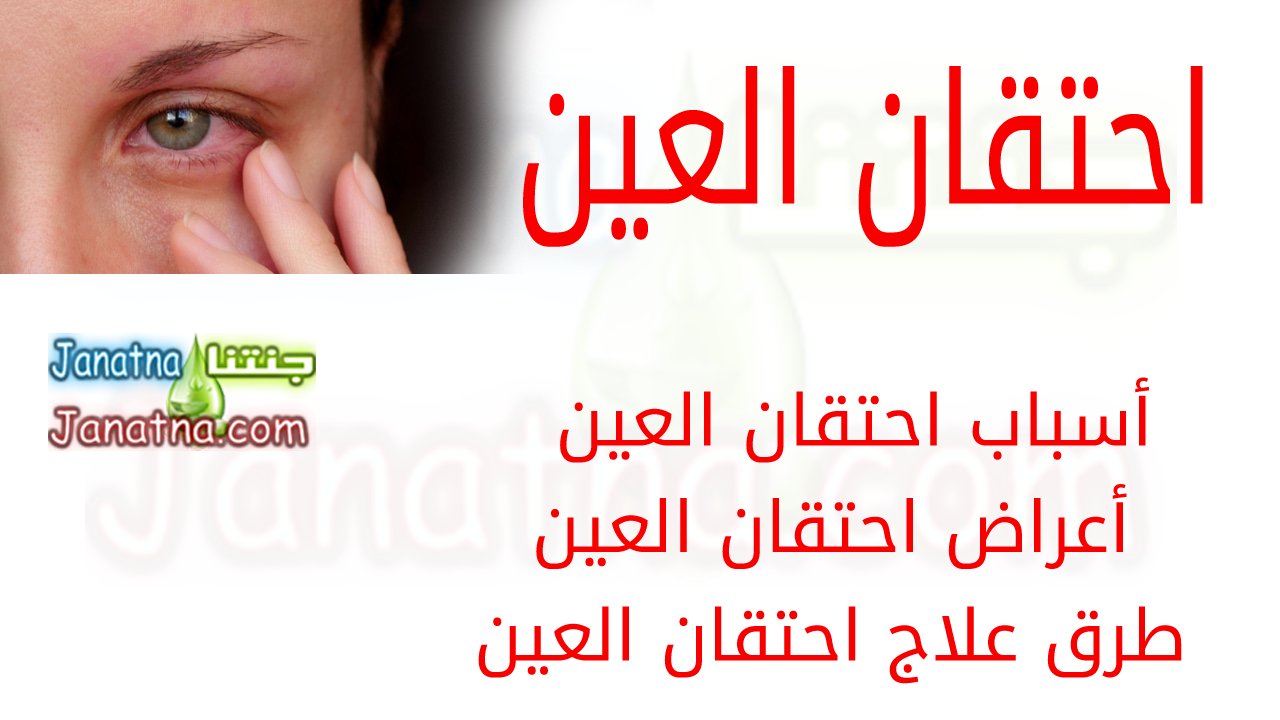 يتعرض الكثير من الناس للإصابة بمرض احتقان العين ن دون أن يدروا ذلك في أغلب الأحيان، وانطلاقاً من هذا الأمر سنقدم لكم من خلال هذا المقال اليوم من موقع صحتي كل ما قد يهمكم حول احتقان العين. أسباب احتقان العين من بين الأسباب العديدة التي يخلق احتقان العين كنتيجة عنها نذكر مشاهدة التلفزيون لساعات طويلة الأمر الذي يجهد العين ويتسبب باحتقانها ومعه هناك الجلسو لفترات طويلة أمام شاشة الكمبيوتر مع القراءة لفترات طويلة وهذه الأمور تمنع رف الجفن الذي بدوره يؤدي الى احتقان العين بالدمع وعدم تصريفها فتنشف وتجهد ويبدأ الشخص من المعاناة من الألم بسببها. من ناحية أخرى بالطبع نذكر تعرض العين لضوء ساطع لفترة طويلة. أعراض احتقان العين يشعر الشخص المصاب باحتقان العين بتعب في العين مع شعور بالإرهاق في الجفنين ومن ثم تبدأ الرؤية بالاضمحلال ويظهر فيها غبش ويصبح كل ما يراه الشخص غير واضح. من الممكن ان تترافق أعراض احتقان العين مع الشعور بصداع قوي في الرأس بالترافق مع الإحساس بالرؤية المزدوجة في الكثير من الأحيان. طرق علاج احتقان العين لكي تقوم العين بدورها المتوجب عليها بصورة طبيعية وجيدة من المهم أن ترتاح بين فترة وأخرى بصورة مستمرة وعلى الشخص الذي يشعر باحتقان العين أن يعمل على تحريك رموشه لمساعدة العين على أن تكون رطبة باستمرار وهذا الأمر يمنع عنها مرض الجفاف. من المهم ان ينظر الشخص المصاب باحتقان العين الى أمور تريح عينيه بخاصة إن كان من الأشخاص الذين يجلسون خلف الحاسوب لفترات طويلة كما ويمكنه أن يتابع علاج لمكافحة احتقان العين من خلال قطرة معينة. من ناحية اخرى هنا بعض الأمور المفيدة والتي قد لا تخطر على بالكم مثل ممارسة الرياضة في الأماكن المفتوحة لأنها تزيد من تدفق الأكسيجين الى الدم مما يساعد العين على إعادة الدورة الدموية. بالطبع ومن دون أن نذكر على الشخص المصاب ان يبتعد عن السهر ويأخذ قسطاً مهماً من الراحة ليريح عينيه مع الامتناع عن التدخين لأن النيكوتين يقود الى انقباض الأوعية الدموية وينصح كذلك بعدم التعرض لأشعة الشمس.