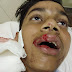 कानपुर : स्कूल से घर आ रहे छात्र को दबंगो ने रॉड से मारकर किया घायल