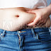 obesity Ayurveda clinic -OBESITY A MODERN VIEW