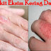 Kulit Telapak Tangan Dan Kaki Selalu Mengelupas