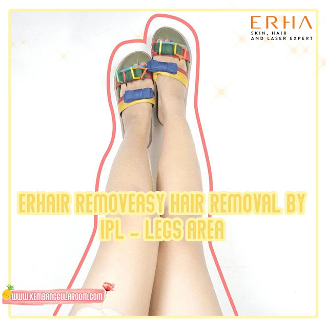 erhair removeasy hair removal by ipl - legs area