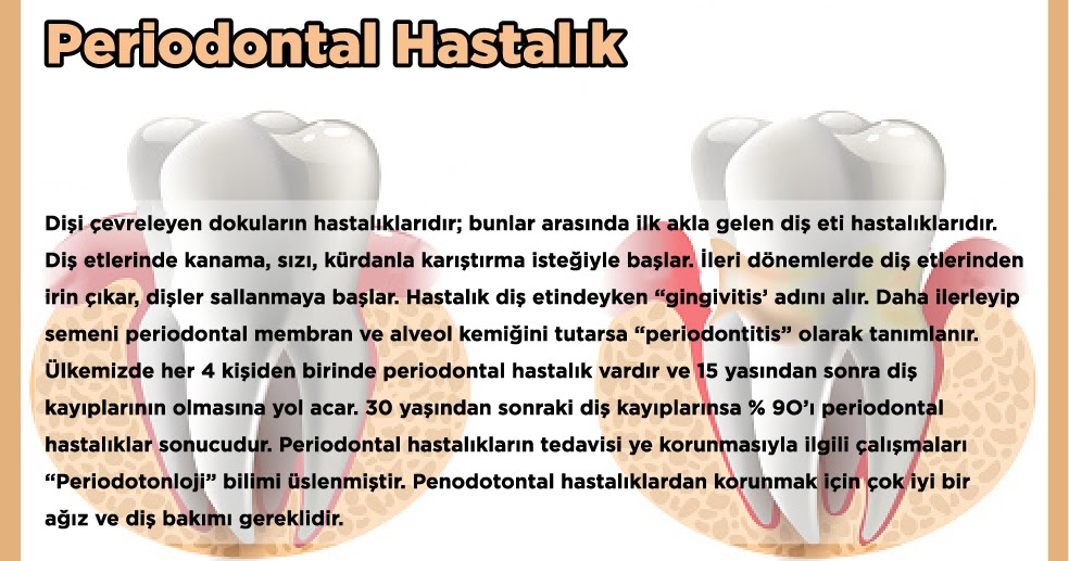 BELİRTİLER Periodontal Hastalık
