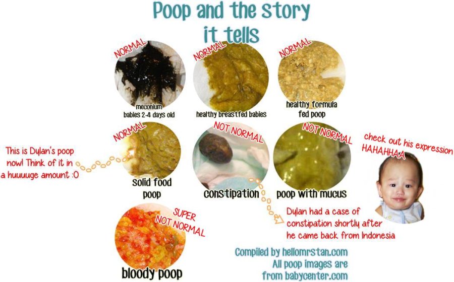 [Pampers Special] Parenting Tip Your Baby's Poo Tells A Story Hello