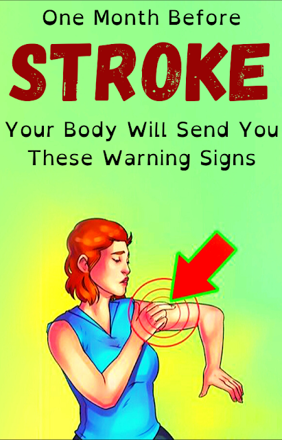 One Month Before Stroke, Your Body Will Send You These Warning Signs ...
