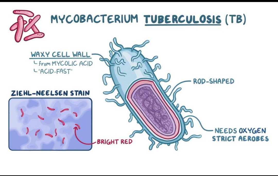 TUBERCULOSIS (TB) PATHOGENESIS,SIGNS, SYMPTOMS AND TREATMENT