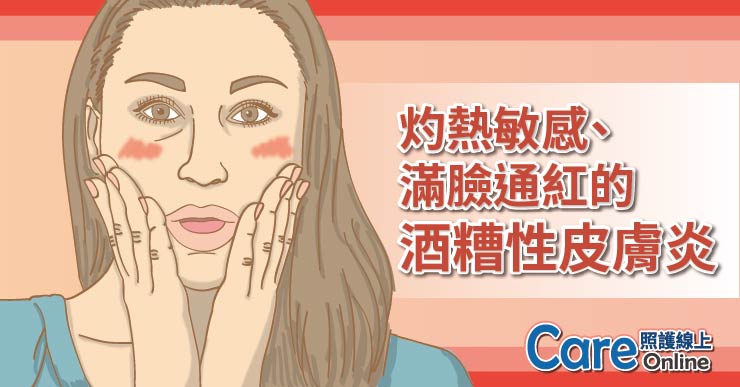 灼熱敏感、滿臉通紅的酒糟性皮膚炎
