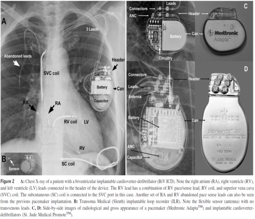 Medtronic Pacemaker X Ray Identification