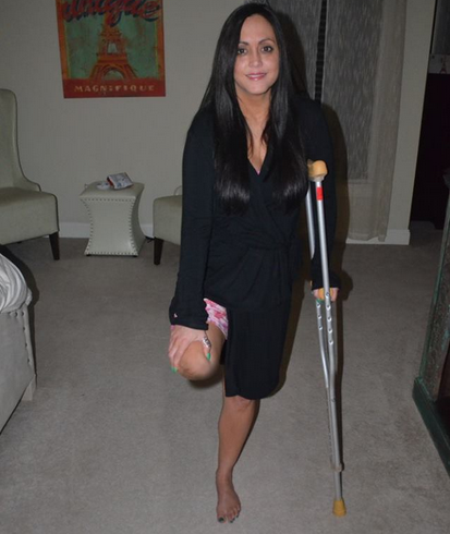 Beautiful girls amputee with crutches.