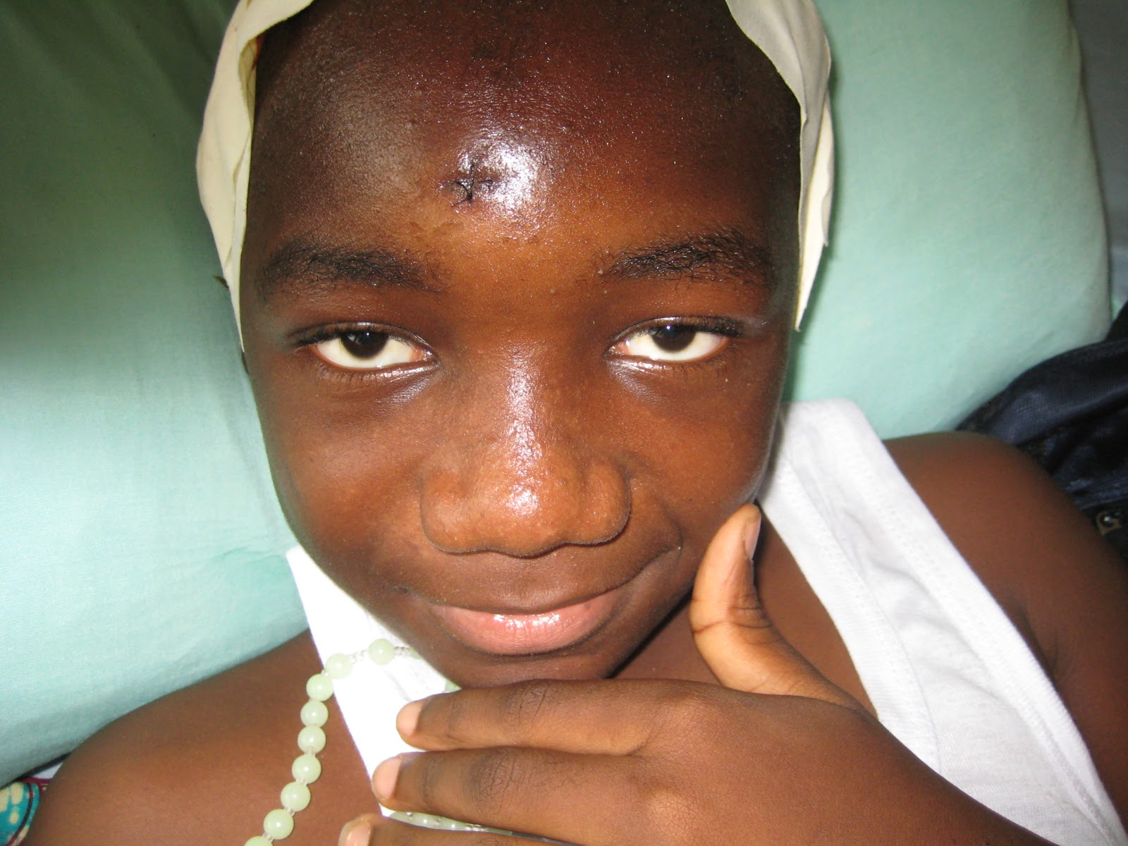 Dr. Murphy in Ghana: Severe complications resulting from untreated