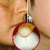 HOMEMADE RECIPE, DISAPPEARS SPOTS AND DARK SKIN PROVEN !!