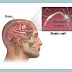 What is convulsion, signs and treatment