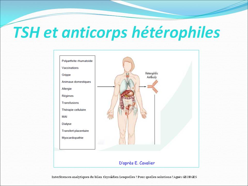 CAnalyses Etudes de Cas Analyses Medicales INTERPRETATION D UNE VARIATION DE TSH mots clés