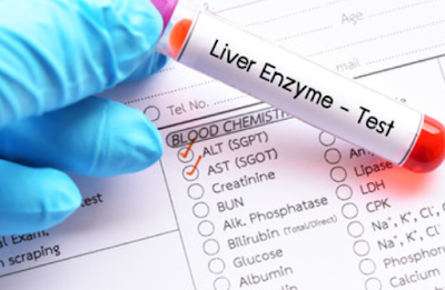 تحليل الانزيم الكبدي ALT