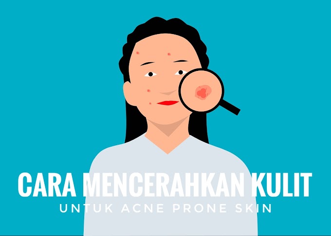 Cara Mencerahkan Kulit untuk Acne Prone Skin