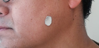 La pancreatitis y atopichesky la dermatitis a