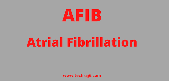 AFIB full form, What is the full form of AFIB