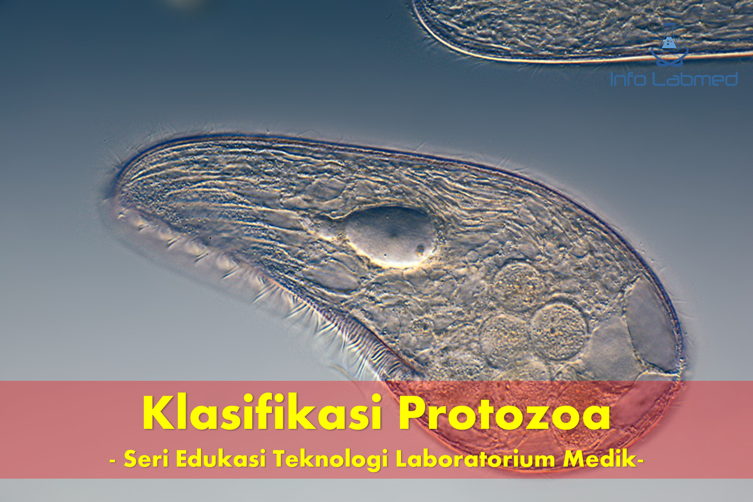 Klasifikasi Protozoa - Seri Edukasi Teknologi Laboratorium Medik