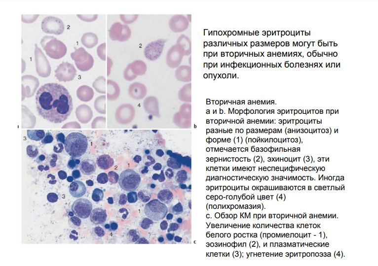 Анемия и эритроциты в крови