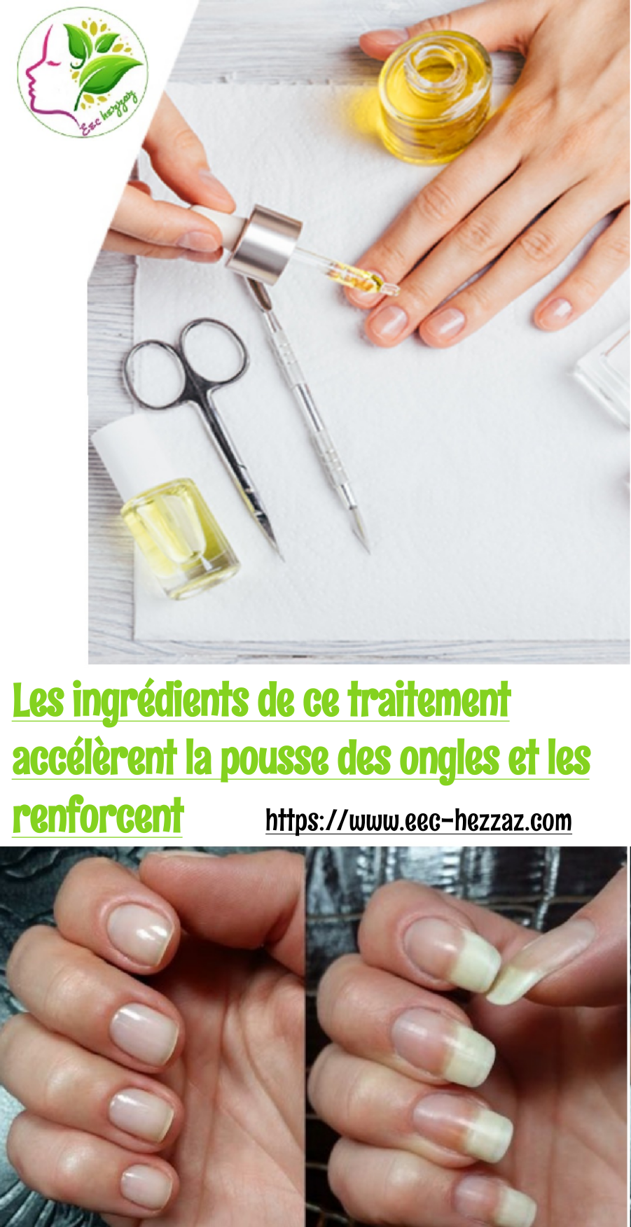 Les ingrédients de ce traitement accélèrent la pousse des ongles et les renforcent